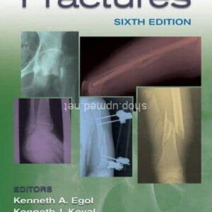 Handbook of Fractures