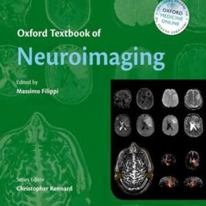 OXFORD TEXTBOOK OF NEUROIMAGING