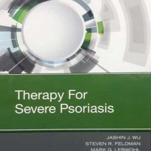 THERAPY FOR SEVERE PSORIASIS