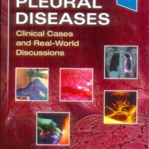 PLEURAL DISEASES: CLINICAL CASES AND REAL-WORLD DISCUSSIONS