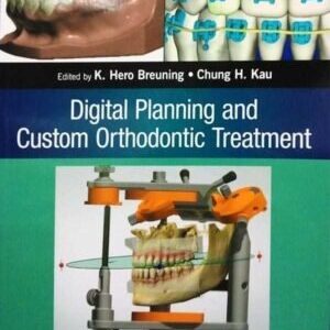 DIGITAL PLANNING AND CUSTOM ORTHODONTIC TREATMENT