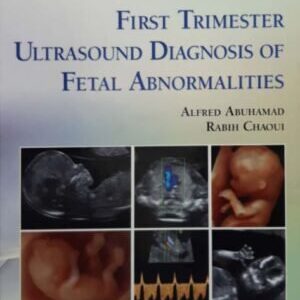 FIRST TRIMESTER ULTRASOUND DIAGNOSIS OF FETAL