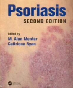 PSORIASIS