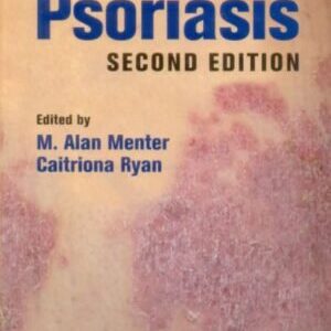 PSORIASIS