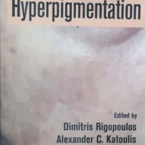 HYPERPIGMENTATION