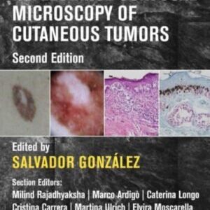 REFLECTANCE CONFOCAL MICROSCOPY OF CUTANEOUS TUMORS
