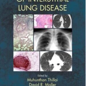 CLINICAL HANDBOOK OF INTERSTITIAL LUNG DISEASE