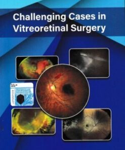 Challenging Cases in Vitreoretinal Surgery