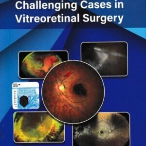 Challenging Cases in Vitreoretinal Surgery