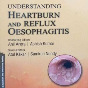 UNDERSTANDING HEARTBURN AND REFLUX OSEOPHAGITS