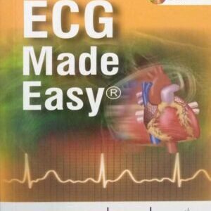 ECG MADE EASY WITH CD-ROM