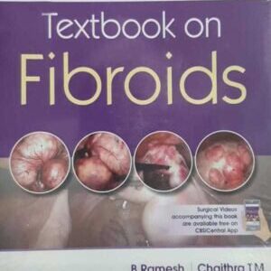 TEXTBOOK ON FIBROIDS