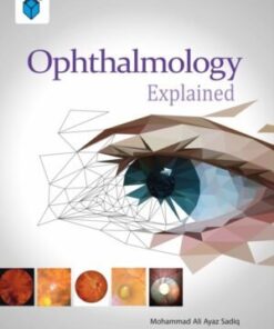 OPHTHALMOLOGY EXPLAINED