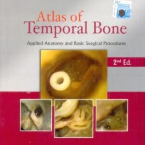 Atlas of Temporal Bone: Applied Anatomy and Basic Surgical Procedures