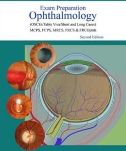 EXAM PREPARATION OPHTHALMOLOGY