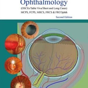 EXAM PREPARATION OPHTHALMOLOGY