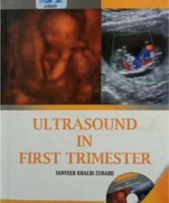 ULTRASOUND IN FIRST TRIMESTER