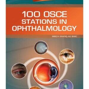 100 OSCE STATIONS IN OPHTHALMOLOGY