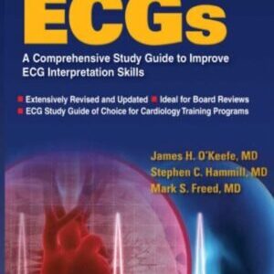 THE COMPLETE GUIDE TO ECGS