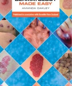 DERMATOLOGY MADE EASY