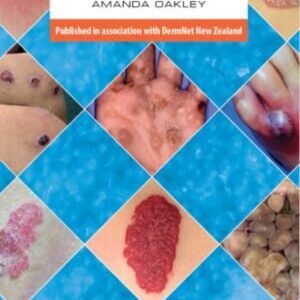DERMATOLOGY MADE EASY