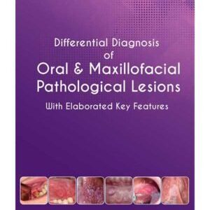 DIFFERENTIAL DIAGNOSIS ORAL MAXILLOFACIAL PATHOLOGICAL LESIONS: WITH ELABORAATED KEY FEATURES