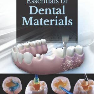 ESSENTIALS OF DENTAL MATERIALS