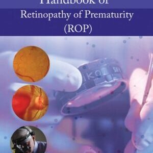HANDBOOK OF RETINOPATHY OF PREMATURITY(ROP) 2023
