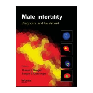 Male Infertility: Diagnosis and Treatment